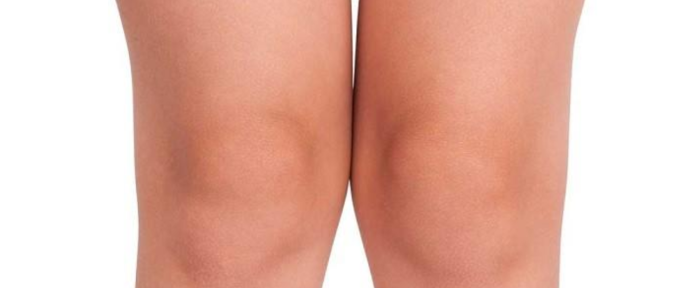 Mengapa Kulit Siku dan Lutut Lebih Gelap dari Bagian Tubuh Lain?